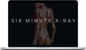 Chase Hughes – 6-Minute X-Ray